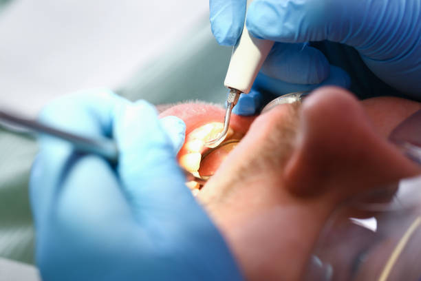 Best Emergency Gum Treatment in Kings Mountain, NC