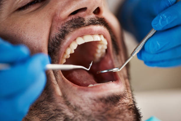 Best Emergency Denture Repair in Kings Mountain, NC