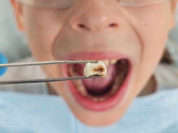 Best Emergency Denture Repair in Kings Mountain, NC
