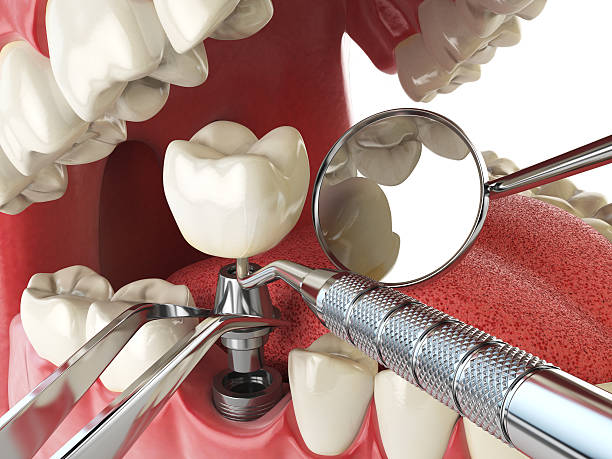 Best Weekend Emergency Dentist in Kings Mountain, NC